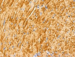 Invitrogen MUC13 Polyclonal Antibody 100 &mu;L; Unconjugated:Antibodies,