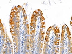 Invitrogen MUC13 Polyclonal Antibody 100 &mu;L; Unconjugated:Antibodies,