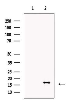 Invitrogen ECRG4 Polyclonal Antibody 100 &mu;L; Unconjugated:Antibodies,