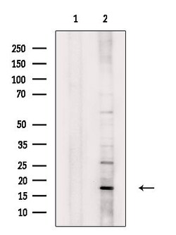 Invitrogen ECRG4 Polyclonal Antibody 100 &mu;L; Unconjugated:Antibodies,