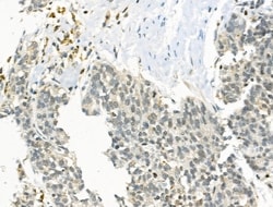 Invitrogen ZMYND8 Polyclonal Antibody 100 &mu;L; Unconjugated:Antibodies,