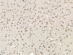 Invitrogen ZMYND8 Polyclonal Antibody 100 &mu;L; Unconjugated:Antibodies,