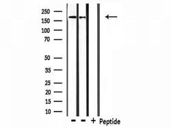 Invitrogen Collagen IV Polyclonal Antibody 100 &mu;L; Unconjugated:Antibodies,
