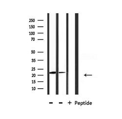 Invitrogen DIRAS1 Polyclonal Antibody 100 &mu;L; Unconjugated:Antibodies,