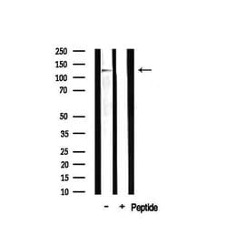Invitrogen MAST2 Polyclonal Antibody 100 &mu;L; Unconjugated:Antibodies,