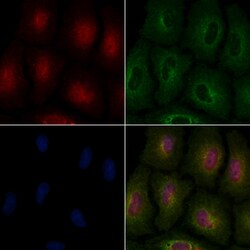 Invitrogen MAGE1 Polyclonal Antibody 100 &mu;L; Unconjugated:Antibodies,