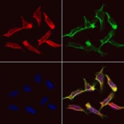 Invitrogen MAGE1 Polyclonal Antibody 100 &mu;L; Unconjugated:Antibodies,