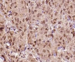Invitrogen MAGE1 Polyclonal Antibody 100 &mu;L; Unconjugated:Antibodies,
