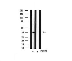 Invitrogen MAGE1 Polyclonal Antibody 100 &mu;L; Unconjugated:Antibodies,