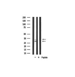 Invitrogen COX11 Polyclonal Antibody 100 &mu;L; Unconjugated:Antibodies,