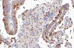 Invitrogen UBXD5 Polyclonal Antibody 100 &mu;L; Unconjugated:Antibodies,