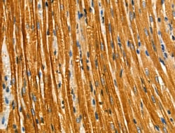 Invitrogen DGKH Polyclonal Antibody 100 &mu;L | Buy Online | Invitrogen&trade; | Fisher Scientific