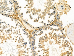 Invitrogen DGKH Polyclonal Antibody 100 &mu;L | Buy Online | Invitrogen&trade; | Fisher Scientific