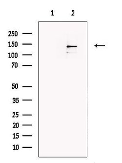Invitrogen DGKH Polyclonal Antibody 100 &mu;L | Buy Online | Invitrogen&trade; | Fisher Scientific