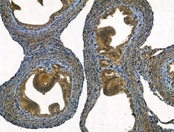 Invitrogen SMAD1/SMAD5/SMAD9 Polyclonal Antibody 100 &mu;L; Unconjugated:Antibodies,