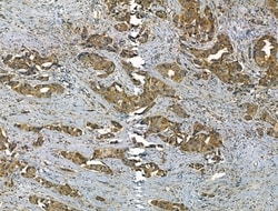 Invitrogen SMAD1/SMAD5/SMAD9 Polyclonal Antibody 100 &mu;L; Unconjugated:Antibodies,