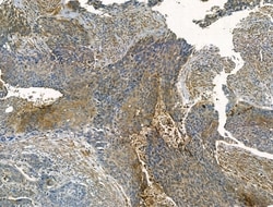 Invitrogen SMAD1/SMAD5/SMAD9 Polyclonal Antibody 100 &mu;L; Unconjugated:Antibodies,