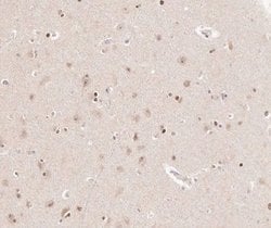 Invitrogen CKS2 Polyclonal Antibody 100 &mu;L; Unconjugated:Antibodies,