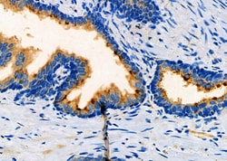 Invitrogen CKS2 Polyclonal Antibody 100 &mu;L; Unconjugated:Antibodies,