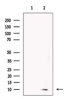 Invitrogen CKS2 Polyclonal Antibody 100 &mu;L; Unconjugated:Antibodies,