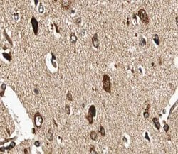 Invitrogen GUCY1B3 Polyclonal Antibody 100 &mu;L; Unconjugated:Antibodies,