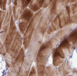 Invitrogen COX17 Polyclonal Antibody 100 &mu;L; Unconjugated:Antibodies,