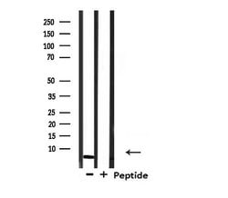 Invitrogen COX17 Polyclonal Antibody 100 &mu;L; Unconjugated:Antibodies,