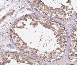 Invitrogen CHOP Polyclonal Antibody 100 &mu;L; Unconjugated:Antibodies,