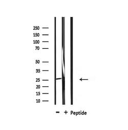 Invitrogen CHOP Polyclonal Antibody 100 &mu;L; Unconjugated:Antibodies,
