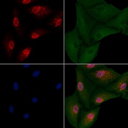 Invitrogen NeuroD2 Polyclonal Antibody 100 &mu;L; Unconjugated:Antibodies,