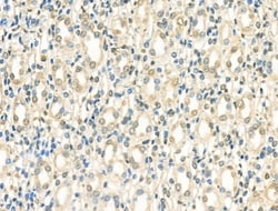 Invitrogen NeuroD2 Polyclonal Antibody 100 &mu;L; Unconjugated:Antibodies,