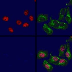 Invitrogen NeuroD2 Polyclonal Antibody 100 &mu;L; Unconjugated:Antibodies,