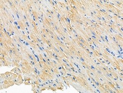 Invitrogen CERKL Polyclonal Antibody 100 &mu;L; Unconjugated:Antibodies,