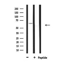 Invitrogen CERKL Polyclonal Antibody 100 &mu;L; Unconjugated:Antibodies,
