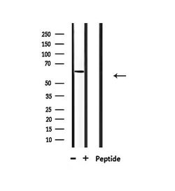 Invitrogen CERKL Polyclonal Antibody 100 &mu;L; Unconjugated:Antibodies,