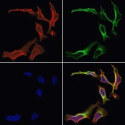 Invitrogen AKAP2 Polyclonal Antibody 100 &mu;L; Unconjugated:Antibodies,