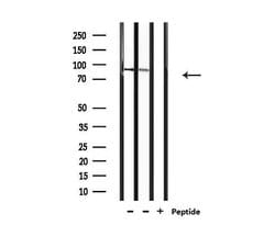 Invitrogen AKAP2 Polyclonal Antibody 100 &mu;L; Unconjugated:Antibodies,