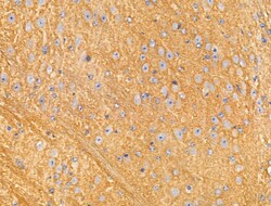 Invitrogen RNF144A Polyclonal Antibody 100 &mu;L; Unconjugated:Antibodies,