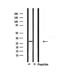 Invitrogen RNF144A Polyclonal Antibody 100 &mu;L; Unconjugated:Antibodies,