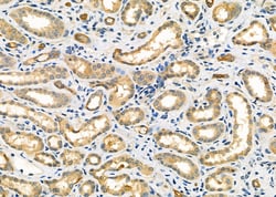 Invitrogen DAK Polyclonal Antibody 100 &mu;L; Unconjugated:Antibodies,