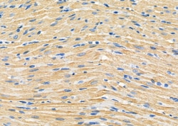 Invitrogen DAK Polyclonal Antibody 100 &mu;L; Unconjugated:Antibodies,