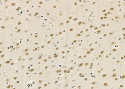 Invitrogen DAK Polyclonal Antibody 100 &mu;L; Unconjugated:Antibodies,