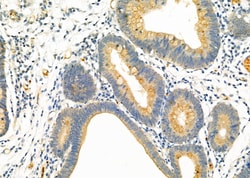 Invitrogen DAK Polyclonal Antibody 100 &mu;L; Unconjugated:Antibodies,