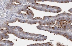 Invitrogen DLEC1 Polyclonal Antibody 100 &mu;L | Buy Online | Invitrogen&trade; | Fisher Scientific