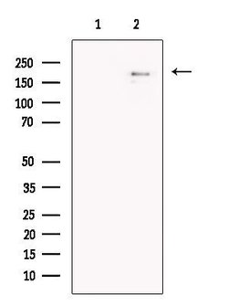 Invitrogen DLEC1 Polyclonal Antibody 100 &mu;L | Buy Online | Invitrogen&trade; | Fisher Scientific