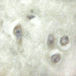 ALPK2 Polyclonal Antibody, Invitrogen 100 &mu;L; Unconjugated:Antibodies,
