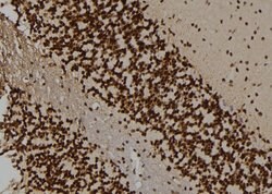 ALPK2 Polyclonal Antibody, Invitrogen 100 &mu;L; Unconjugated:Antibodies,