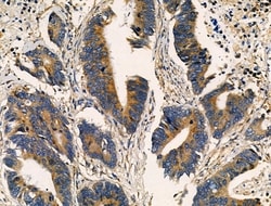 ALPK2 Polyclonal Antibody, Invitrogen 100 &mu;L; Unconjugated:Antibodies,