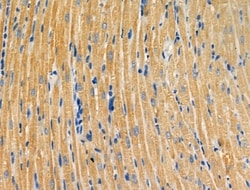 ALPK2 Polyclonal Antibody, Invitrogen 100 &mu;L; Unconjugated:Antibodies,