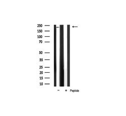 ALPK2 Polyclonal Antibody, Invitrogen 100 &mu;L; Unconjugated:Antibodies,